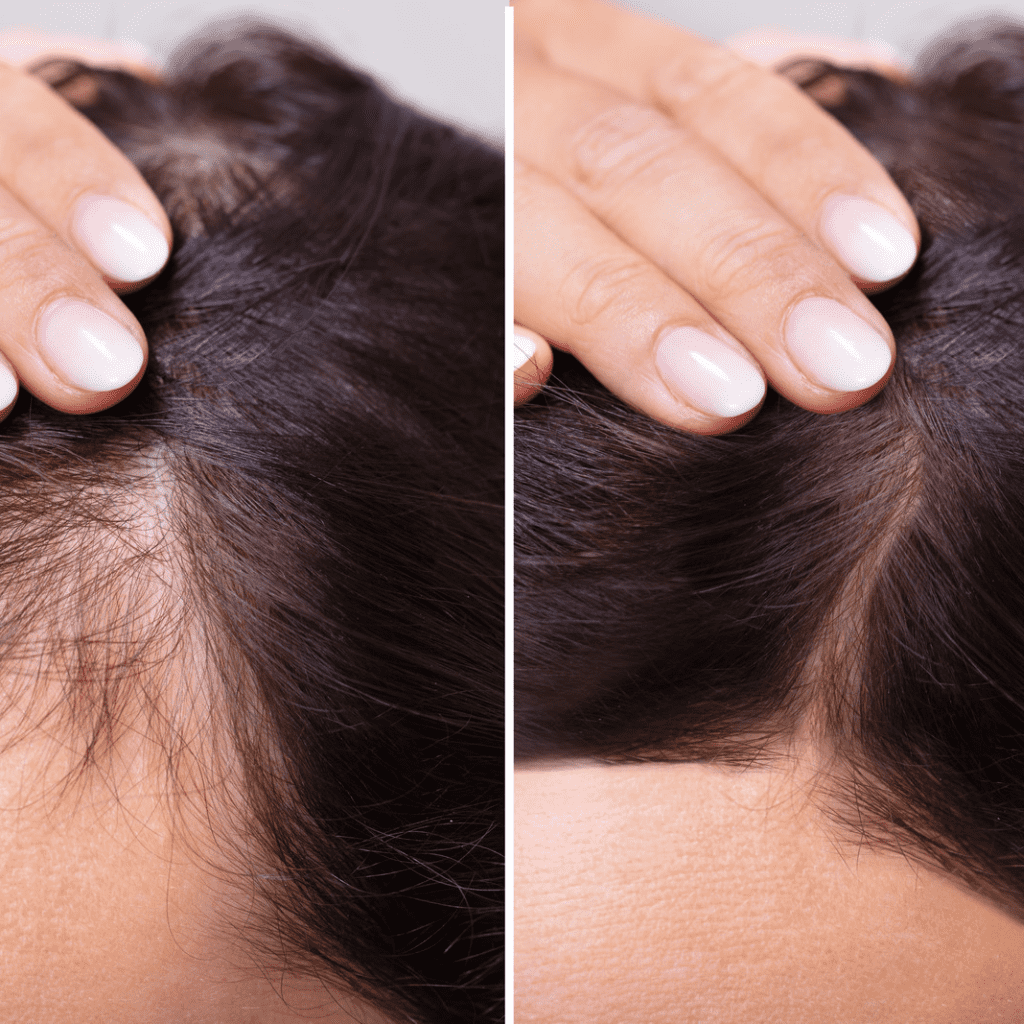MULTI-PEPTIDE SERUM FOR HAIR DENSITY PARA ESTIMULAR Y FORTALECER EL CRECIMIENTO DEL CABELLO - Tu Shopper Beauty
